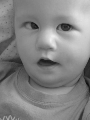 Hipopituitarizm Belirtileri ve Tedavisi