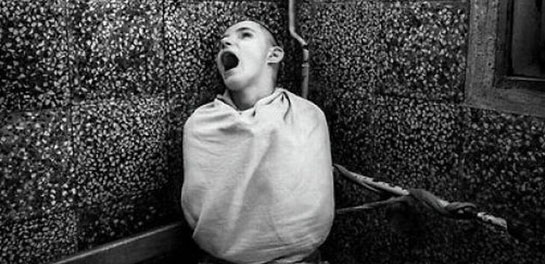 Sinir Hastalıkları Belirtileri ve Tedavisi